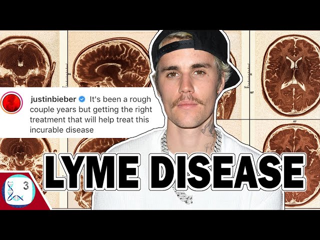 Lyme Disease Is On The Rise. And It's Bad.