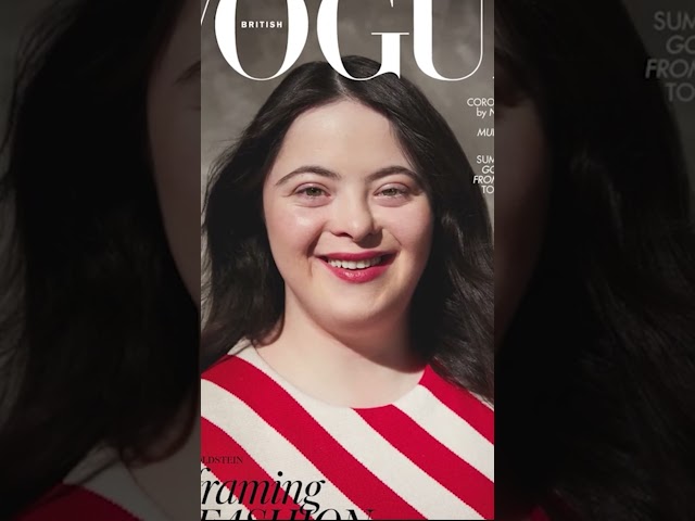 20-year-old with Down syndrome becomes model