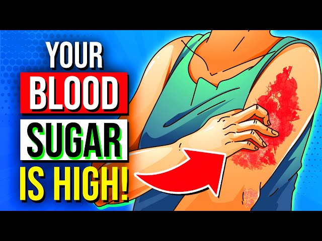 16 ALARMING Signs Your Blood Sugar Is HIGH & 8 Diabetes Symptoms