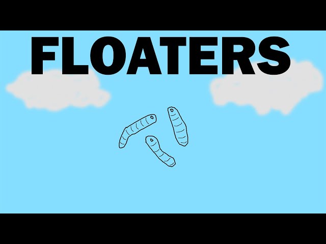 Floaters in your eyes ! ( आपकी आंखों में Floaters ! )