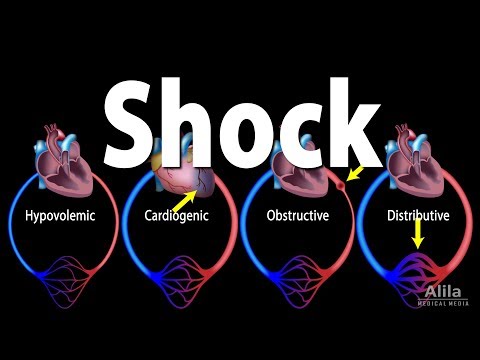 Shock, Pathology of Different Types, Animation