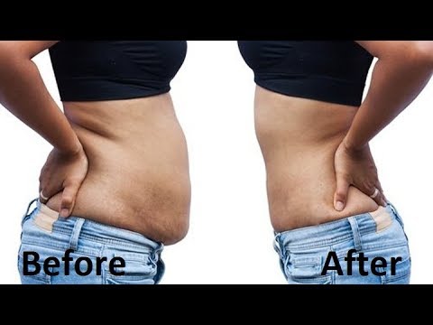 Fitness and Weight Loss - How to lose belly fat l Burn belly fat and get flat stomach