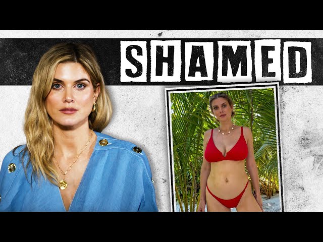 I have been body shamed for my boobs since age 13, says Ashley James
