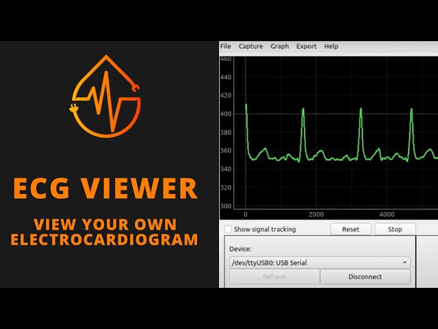ECG Viewer Install for Windows and MacOS