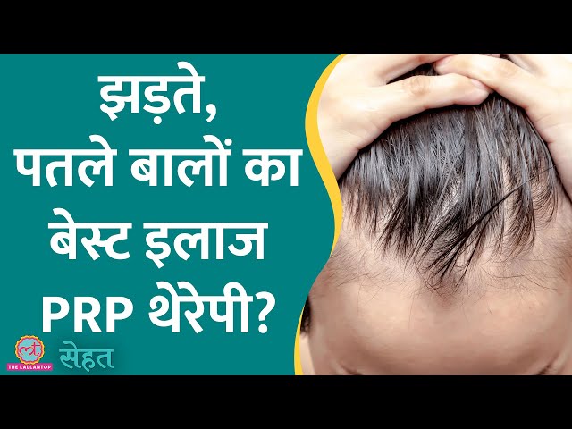 Hair Loss, Thinning Hair ठीक करने वाली PRP Therapy क्या है? | Sehat ep 837