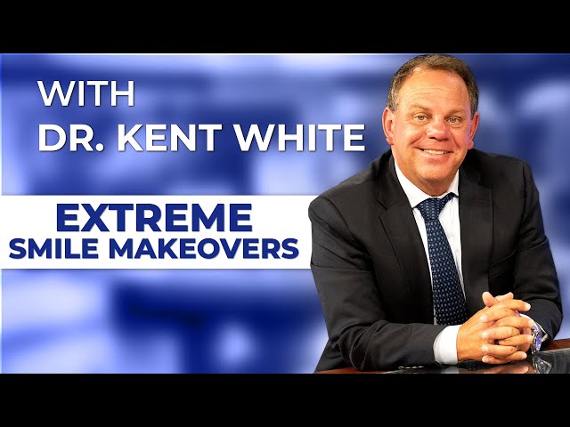 Full Mouth Reconstruction with Dr. Kent White | Oceanside, CA Dentist
