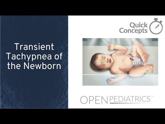 Transient Tachypnea of the Newborn by M. Connelly, et al. | OPENPediatrics