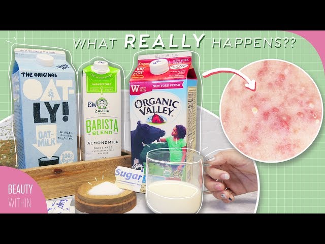 Skincare Mistakes That Cause Acne, Breakouts & Inflammation: Sugar & Dairy