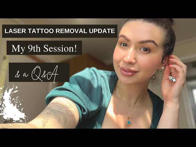 Laser Tattoo Removal Update After 9th Session & Laser Q&A