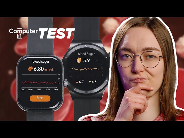 Blutzucker per Smartwatch messen: Geht es schon ohne Pieks?