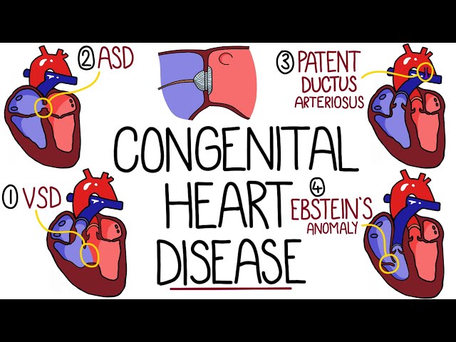 Congenital Heart Malformations Made Easy (8 Main Types)