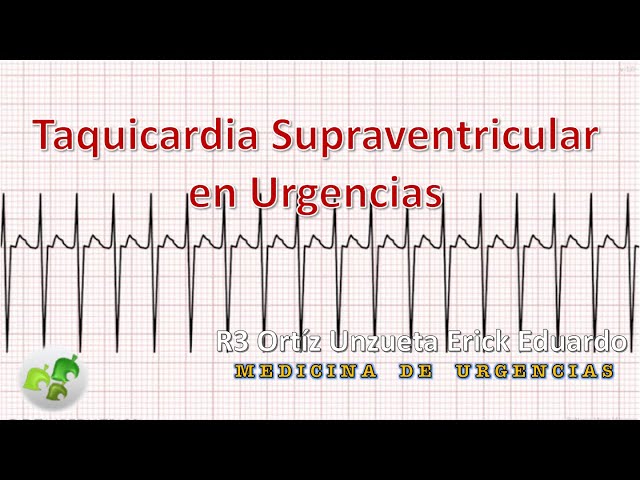 Taquicardia Supraventricular en Urgencias