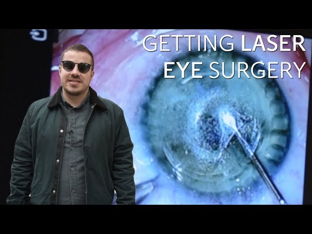 Laser eye surgery: Here's what it's like to have the procedure