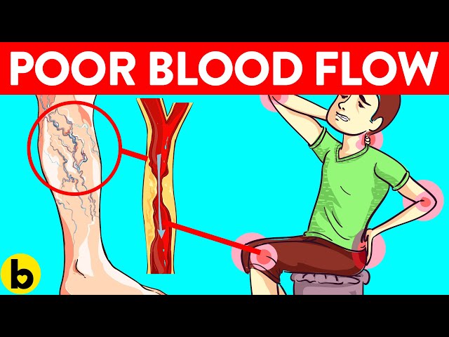 5 Causes of Poor Blood Circulation