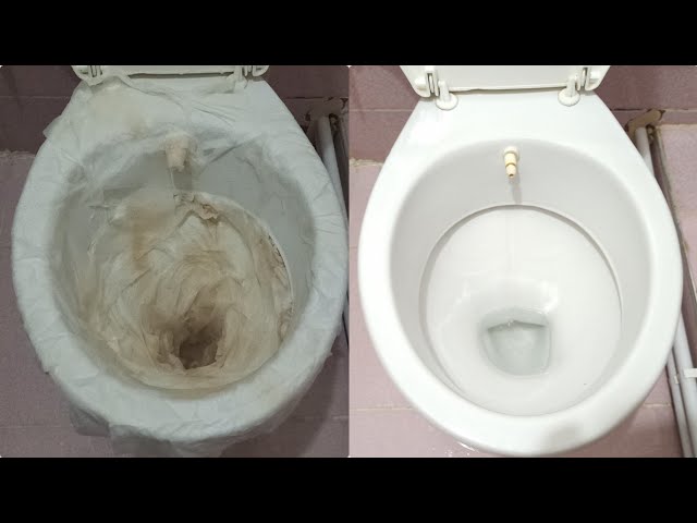 Like a Miracle! Blackened and Calcified Toilet Bowl Cleaning Method
