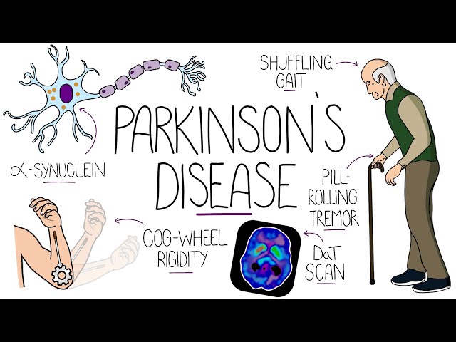 Understanding Parkinson's Disease (Including Direct and Indirect Pathways)