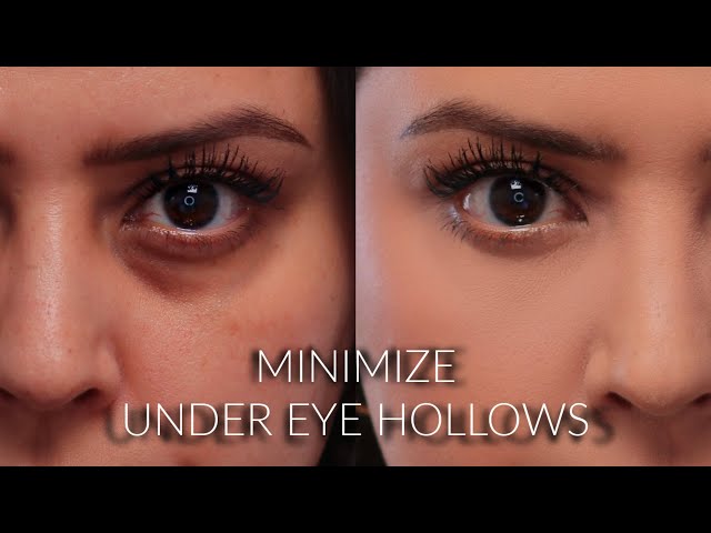 How To Minimize the Appearance of Under-Eye Hollows and Conceal Dark Circles