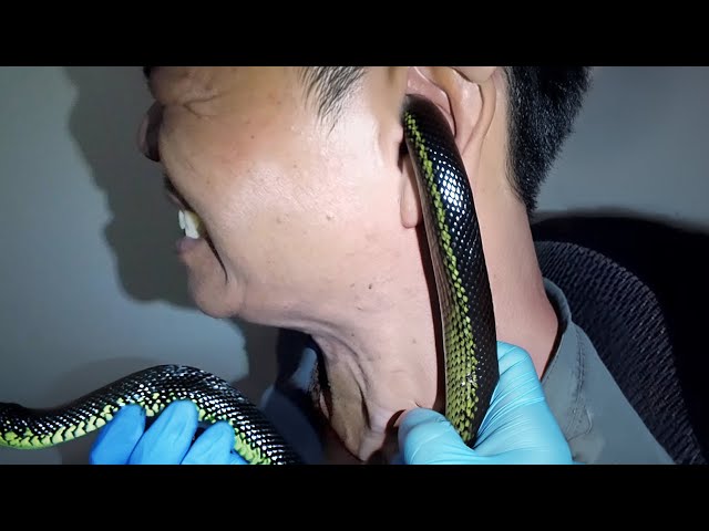 snake got stuck in his ear..