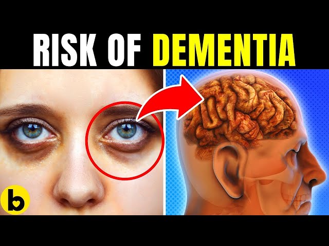 8 Everyday Habits That May Increase Your Risk Of Developing Dementia