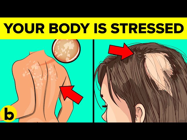 8 Important Signs That Your Body Is Very Stressed