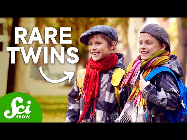 6 Types of Twins That Are Extremely Rare