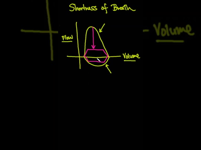 Shortness of Breath - Flow Volume Loop