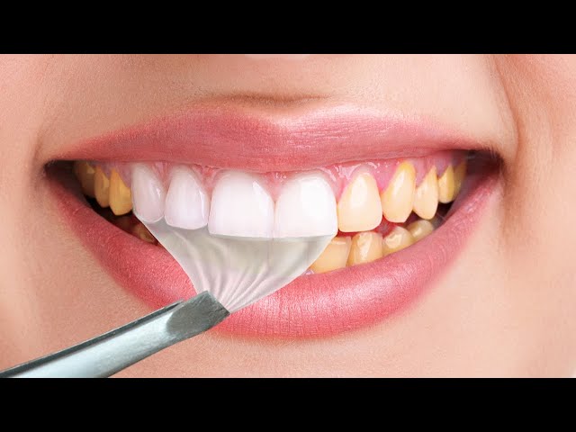 A PERFECT SMILE IN A MINUTE!?? SMART TRICKS AND TIPS YOU WANT TO TRY!