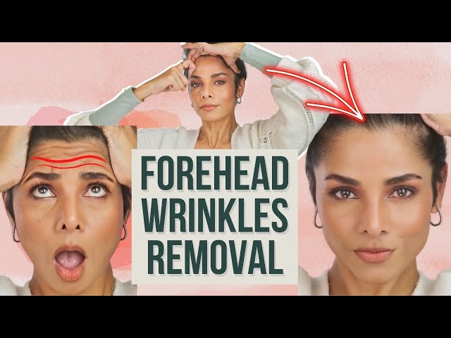 How to REMOVE FOREHEAD WRINKLES and TIGHTEN Forehead Skin Without Botox
