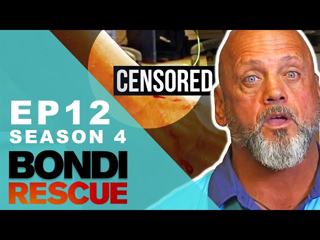 HUGE Fishing Hook Gets Stuck! | Bondi Rescue - Season 4 Episode 12 (OFFICIAL UPLOAD)