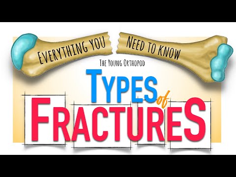Bone Fracture: Types & Mechanisms | ANIMATION | Fracture classification | The Young Orthopod NEET PG