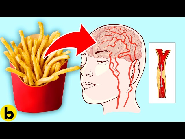 This Is What Fast Food Does To Your Brain