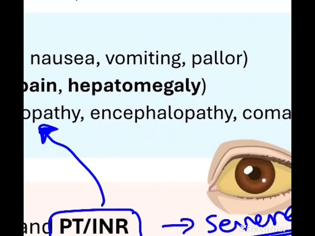 Paracetamol poisoning in a nutshell