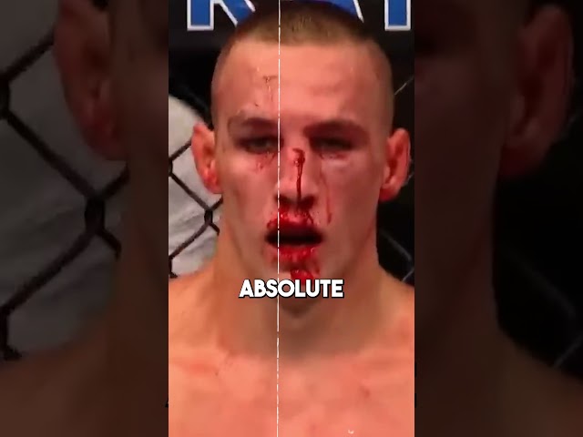 When Robbie Lawler CRUSHED Rory MacDonald's Nose #shorts