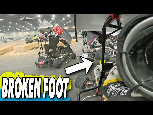 A Car Crushed My Feet At Full Speed... (BROKEN FOOT?)