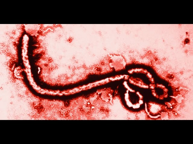 Ebola - Health bosses on plans to deal with disease - Truthloader