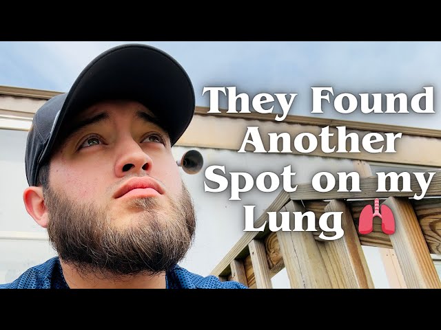 Update on My Lung Cancer: They Found Another Spot