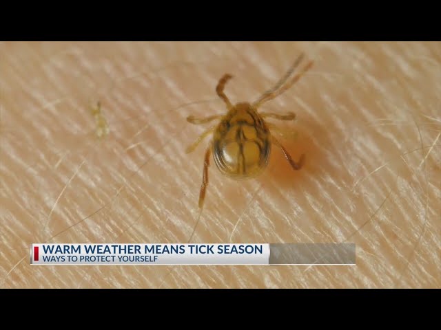 Warm weather means tick season in central Ohio