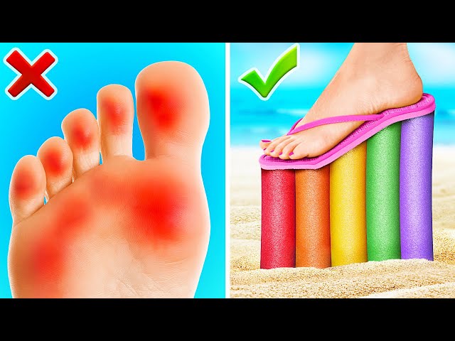 DON'T BURN YOUR FEET!😱 Awesome Summer Survival & Beach Hacks by GIGAZOOM
