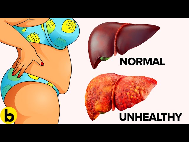 10 Warning Signs That Your Liver Is Full Of Toxins