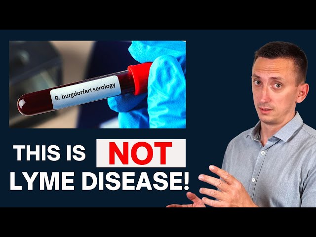 The Problem With Lyme Disease
