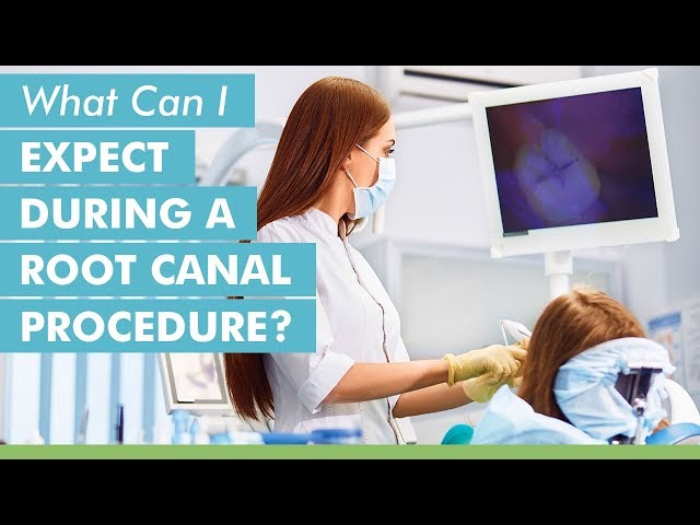 What Can I Expect During A Root Canal Procedure?