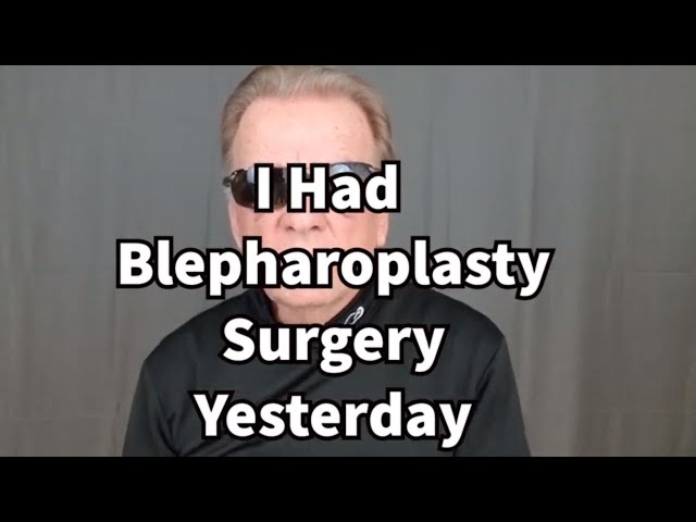I Had Blepharoplasty Surgery Yesterday. Eyelid Surgery Day #1 After Surgery