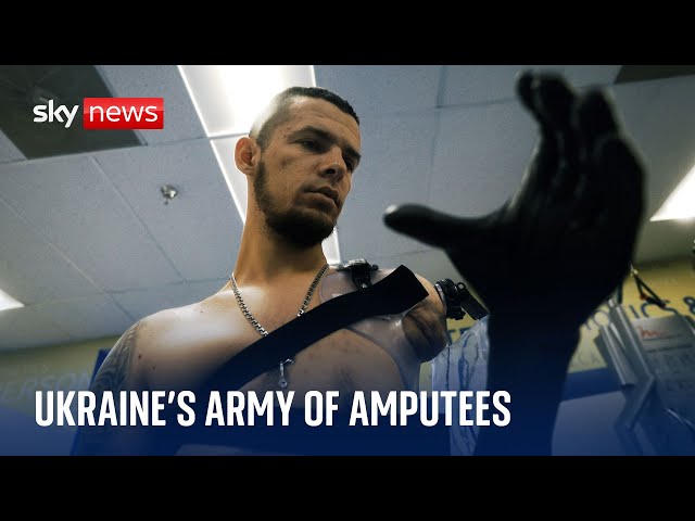 Ukraine War: At least 25,000 people have lost limbs in less than two years