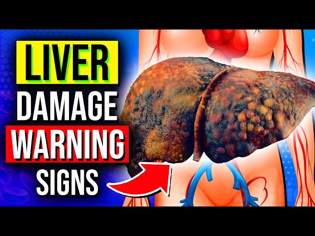 DON'T IGNORE These 6 Warning Signs Of Liver Damage Before It's Too Late