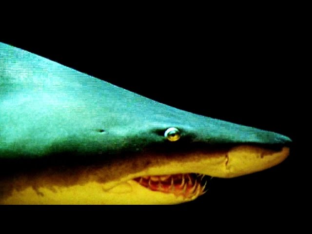Shark Bites - Surviving a Horrific Attack