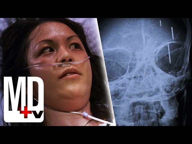 Her parents inserted PINS IN HER BRAIN as an infant! | House M.D. | MD TV