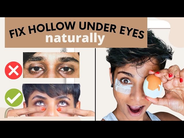 How to PLUMP UP HOLLOW UNDER EYES naturally