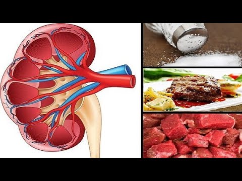 Kidney cleanse