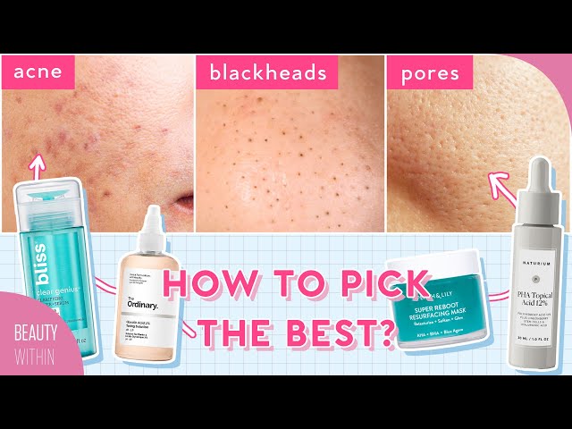 AHA, BHA, PHA: How to Use Chemical Exfoliants For Acne, Hyperpigmentation & Large Pores & More!