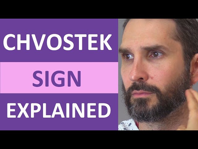 Chvostek's Sign: Positive vs Negative Sign Assessment - Nursing Clinical Skills